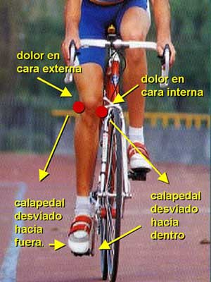 rodilla